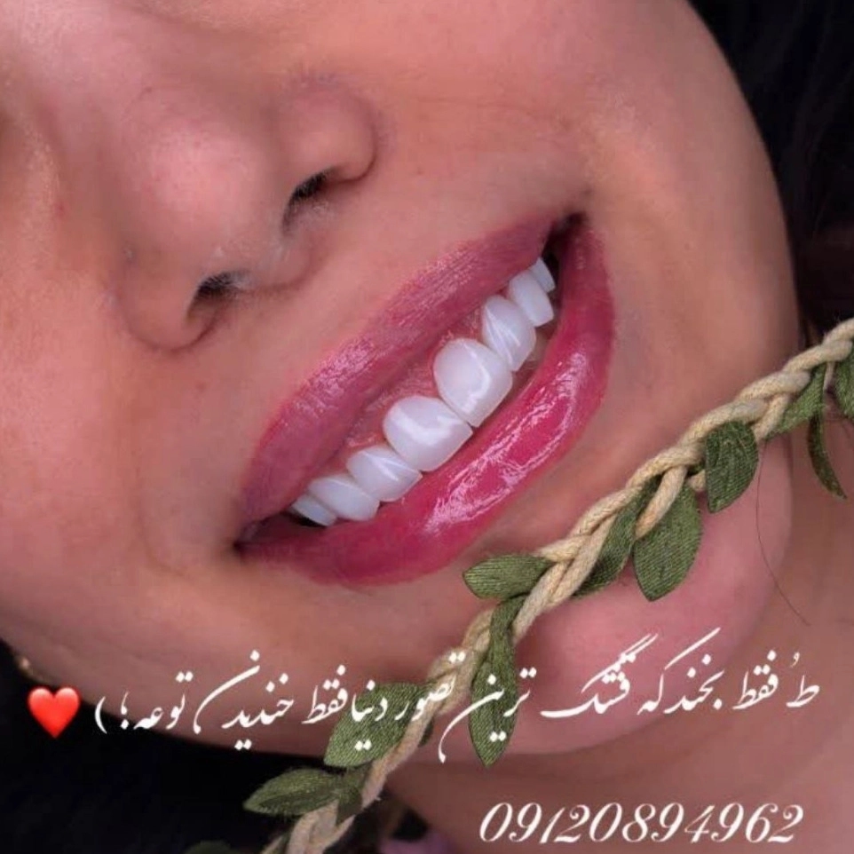 1780742927321.webp