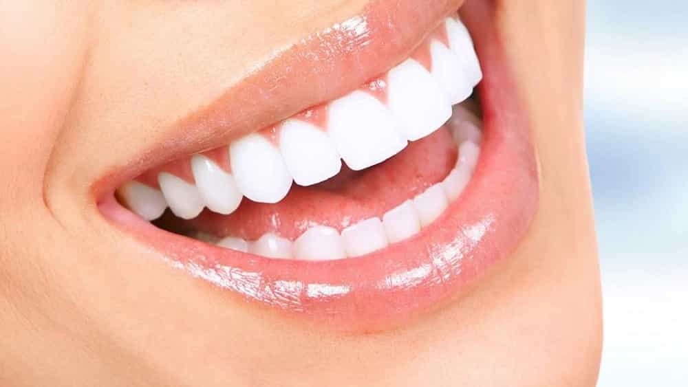 رزرو نوبت لمینت و کامپوزیت دندان در تهران با مشاوره تخصصی