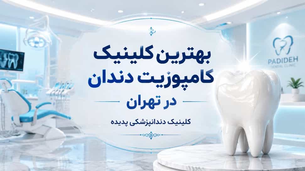 بهترین کلینیک کامپوزیت دندان در تهران