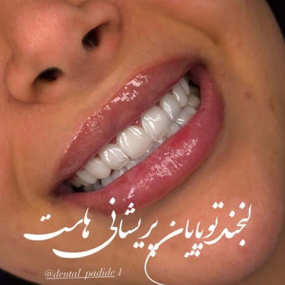 1778564472117.webp