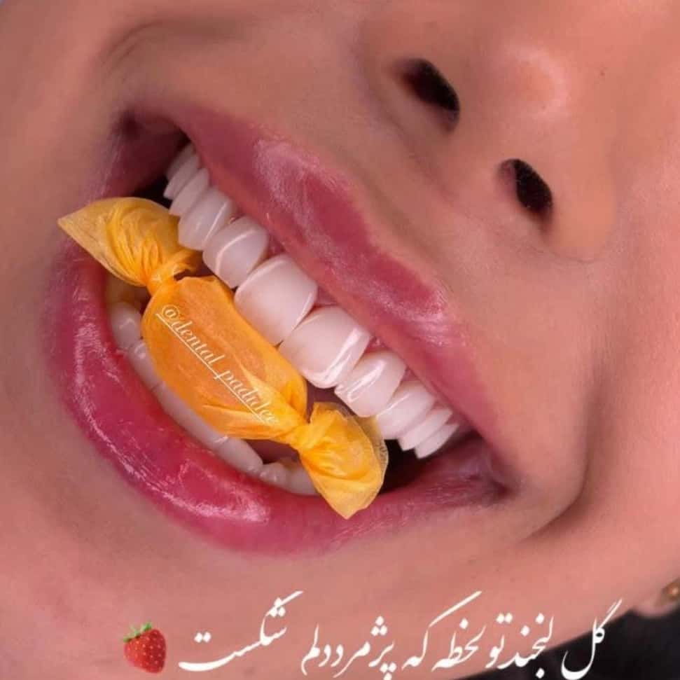 1778564632588.webp