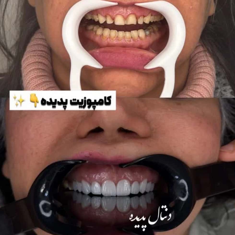 1779521916885.webp