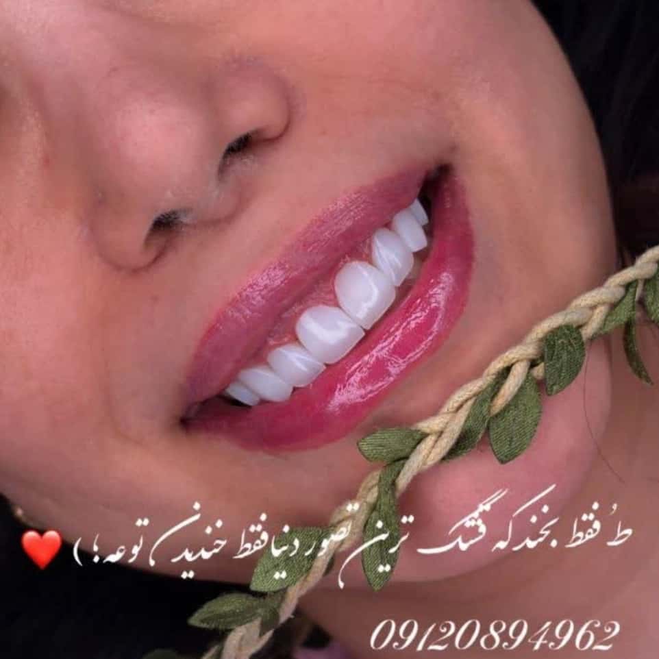 1780742927321.webp