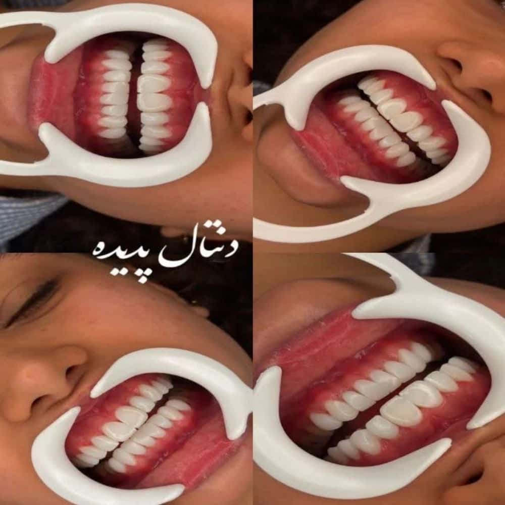 1780742980938.webp